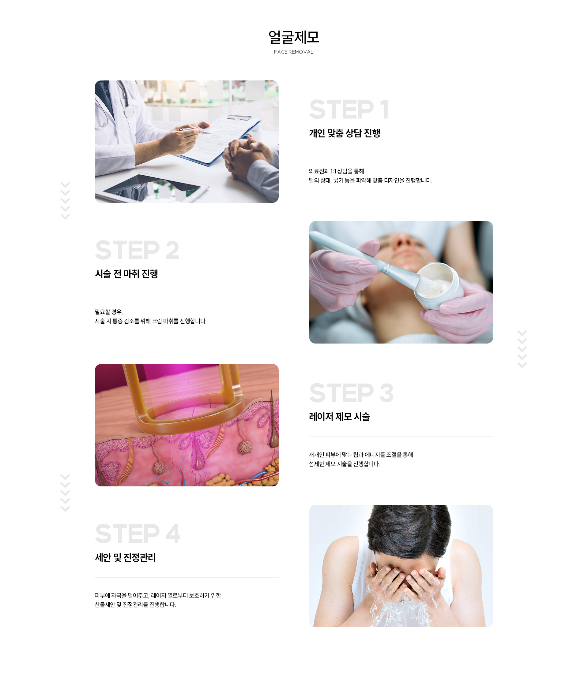제모과정 얼굴제모