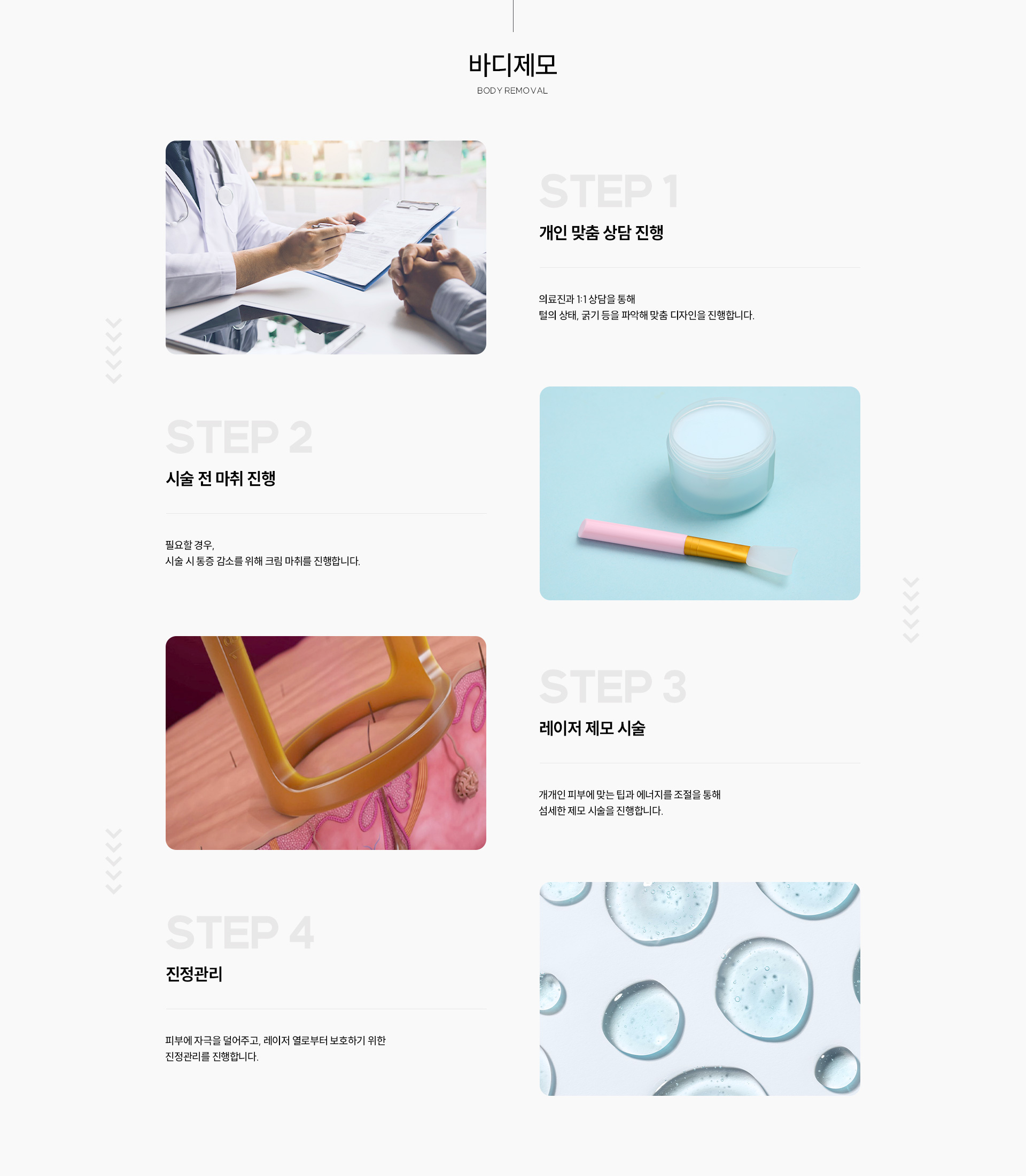 제모과정 바디제모
