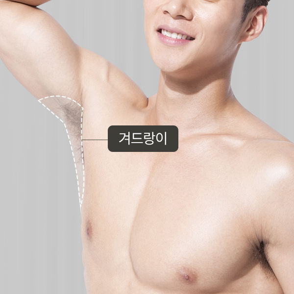 겨드랑이 제모