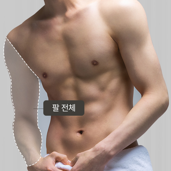 팔 전체 제모